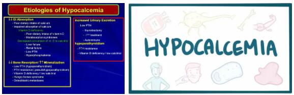 Hypocalcemia Guide